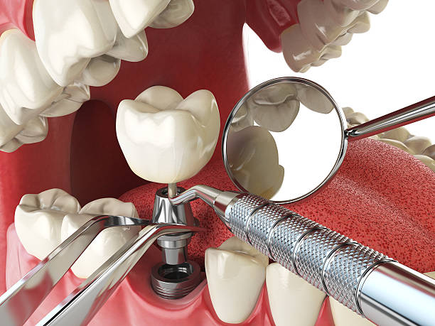 Best Mobile Emergency Dentist in Edmore, MI